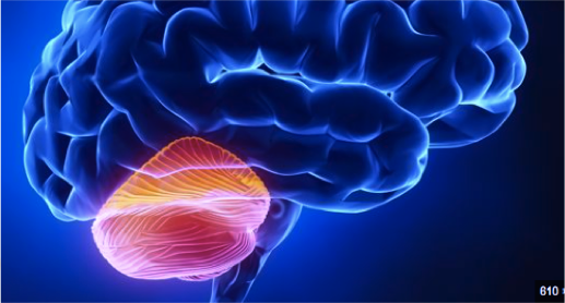 ¿Qué es la ataxia?